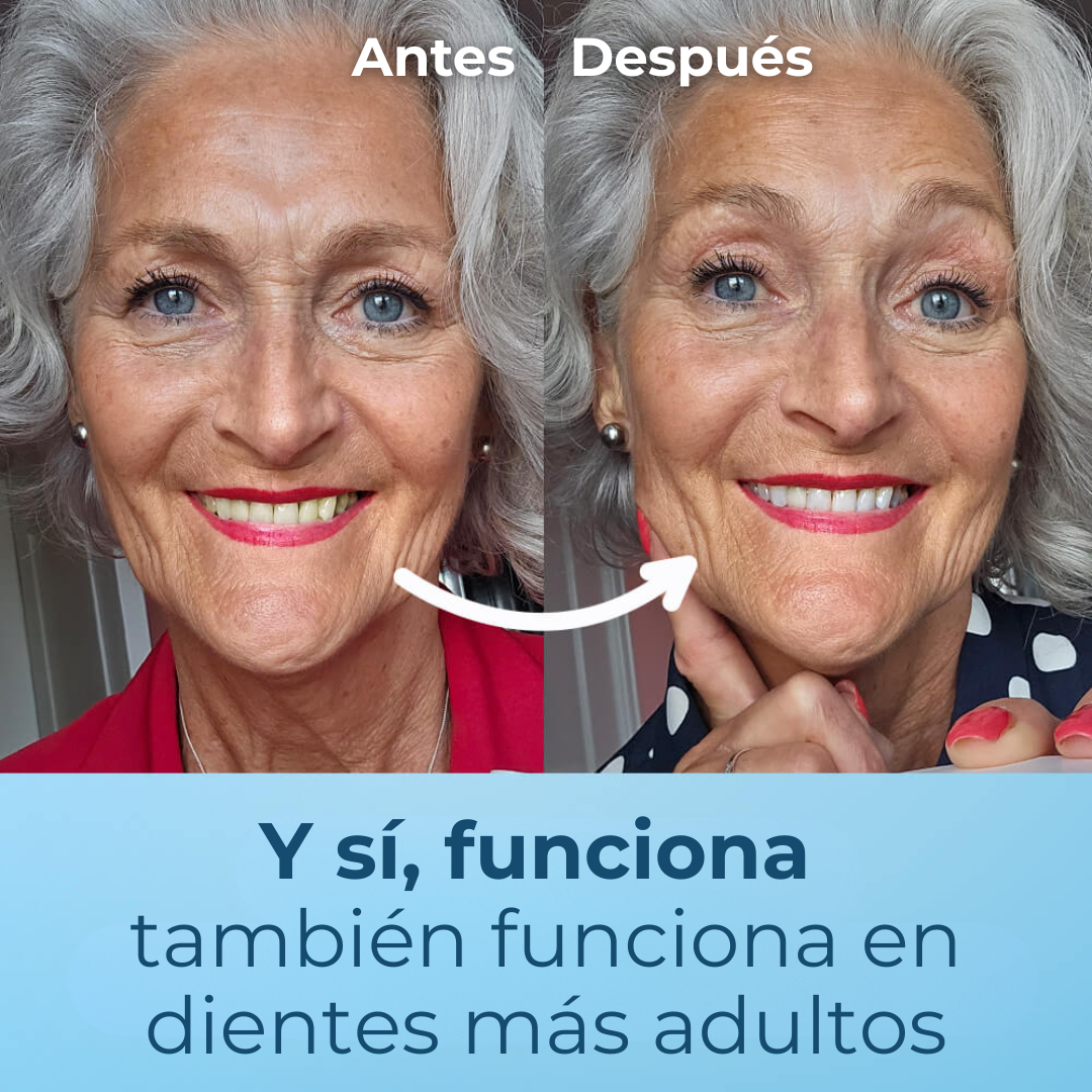 Polvo Blanqueador de Dientes